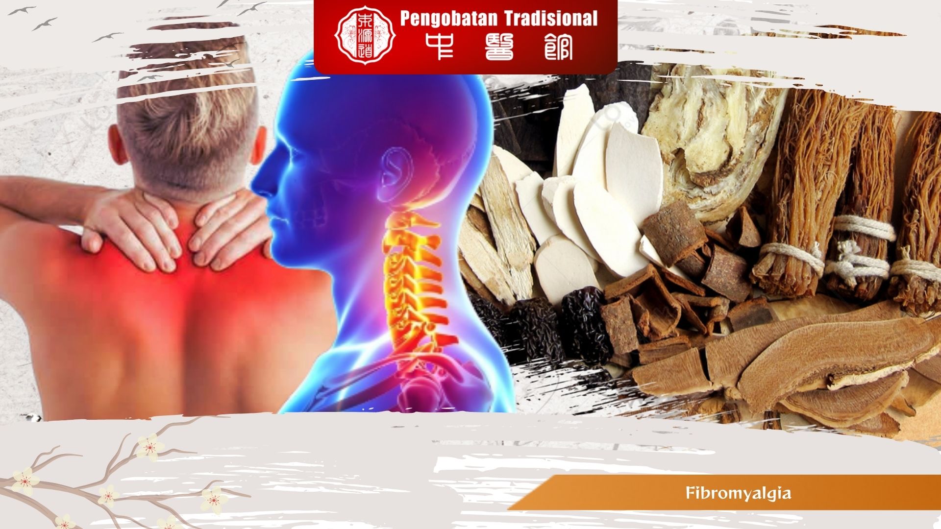 Fibromyalgia Mengganggu Aktivitas? Temukan Solusi dan Perawatanya