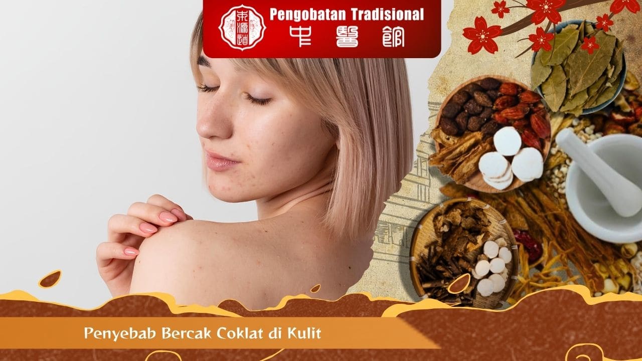 Penyebab Bercak Coklat di Kulit